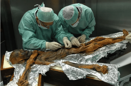 Otzi