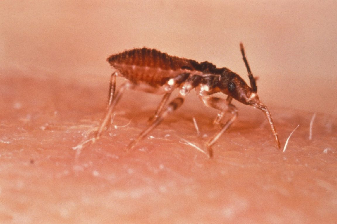 maladie chagas punaise triatomine