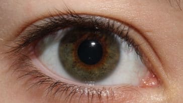oeil