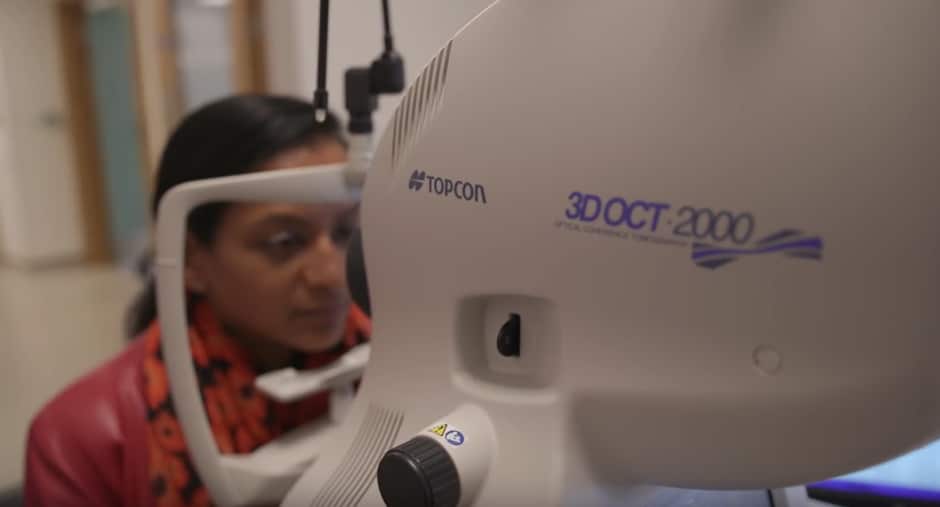 oeil appareil deepmind