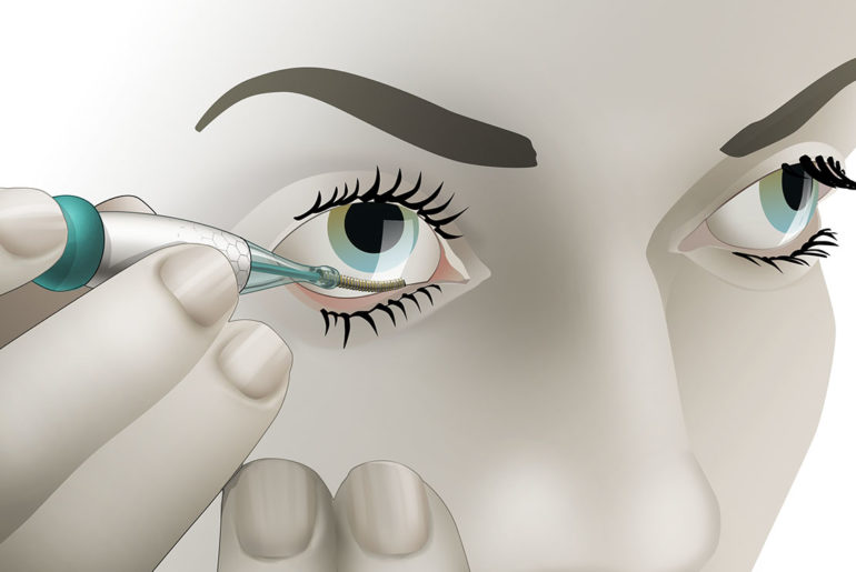 dispositif taux glycémie