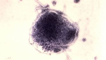 virus rougeole maladie