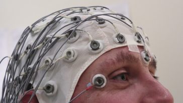 Electroencephalographie