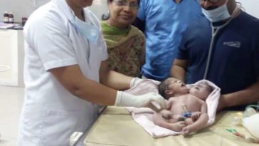 Dicephalus dibrachius siamois inde