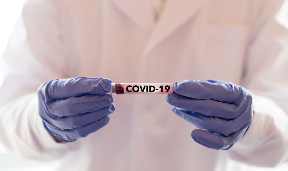 COVID-19 coronavirus