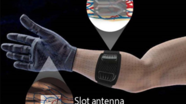 brassard gant diabète