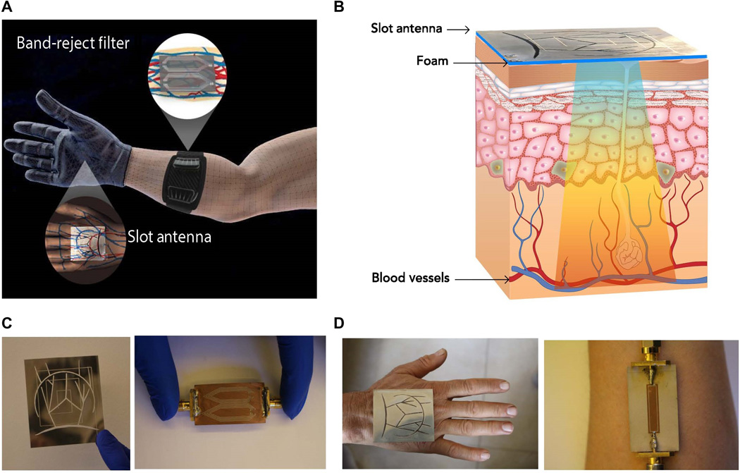 gant brassard diabète