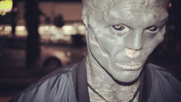 ablation du nez artiste 3