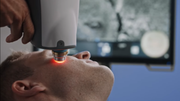 appareil cancer peau diagnistic 2