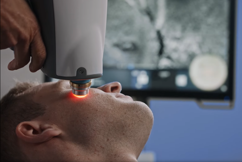 appareil cancer peau diagnistic 2