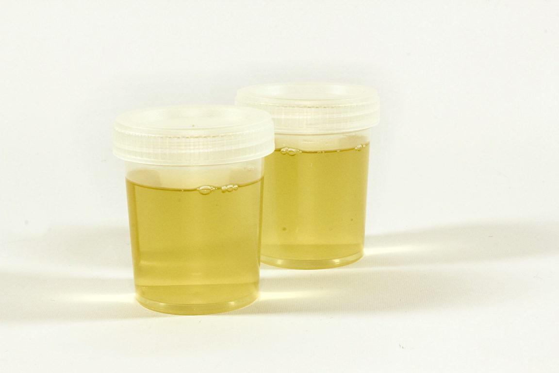 urine