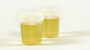 urine