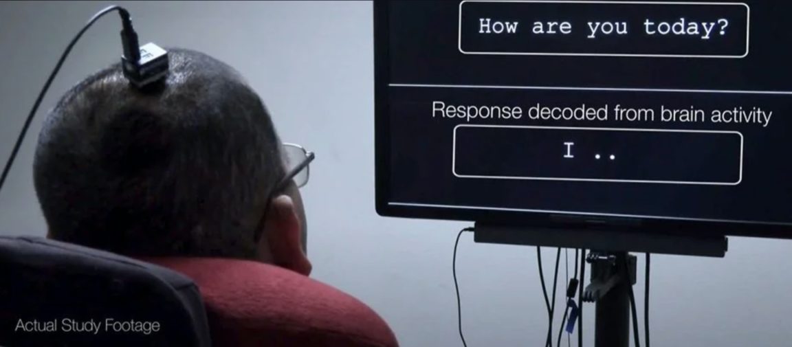 paralysé implant cerveau