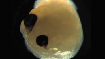 mini cerveau yeux organoïdes cérébraux