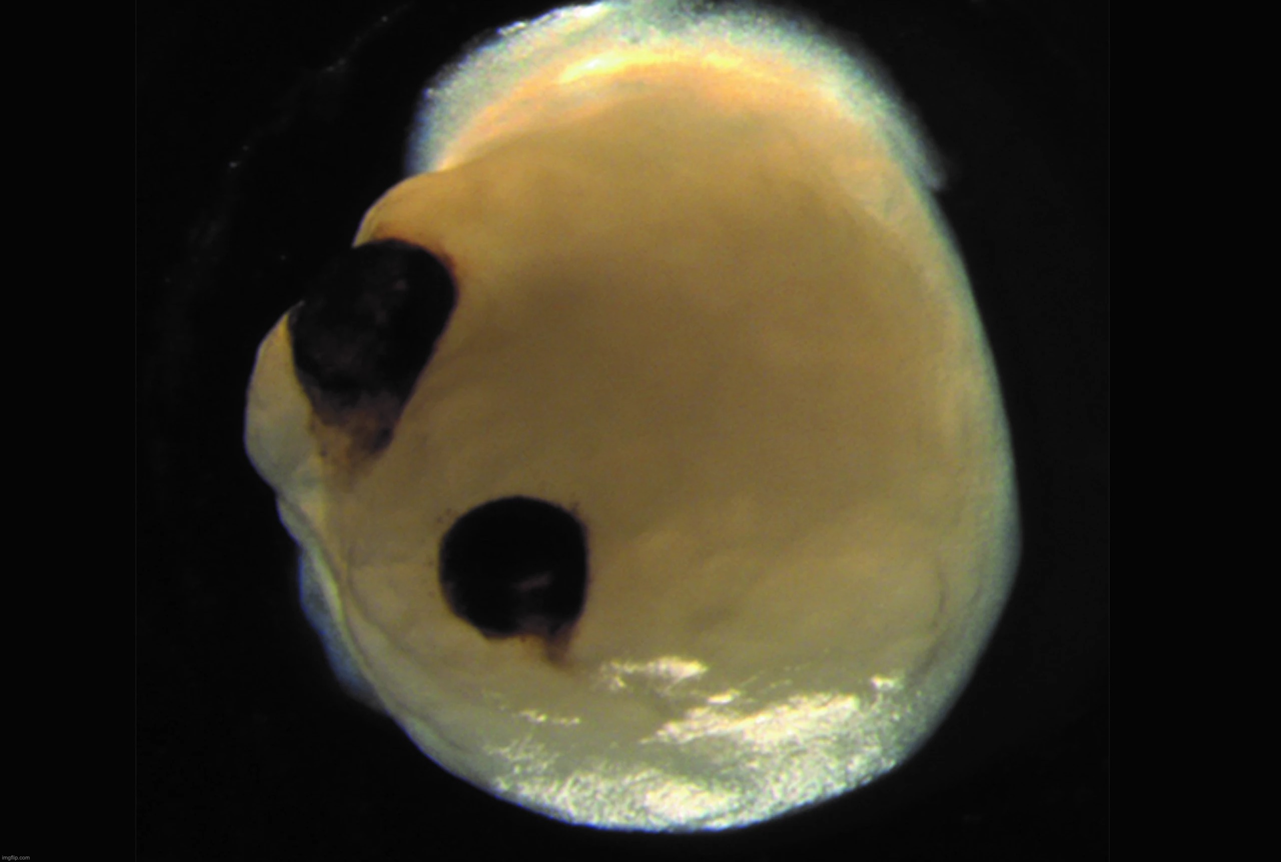 mini cerveau yeux organoïdes cérébraux