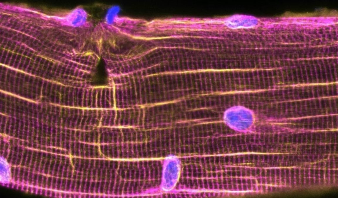 muscles cellules musculaires