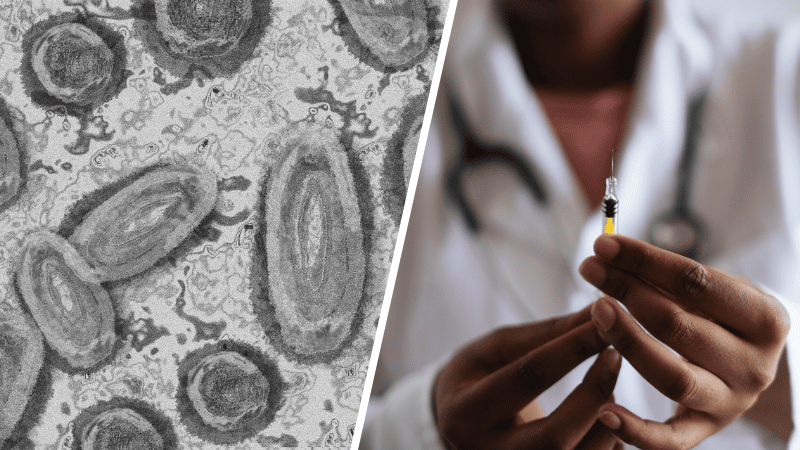 vaccin sérum contre variole du singe