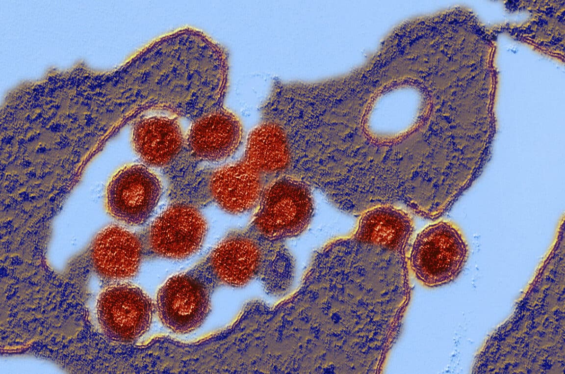 virus placenta
