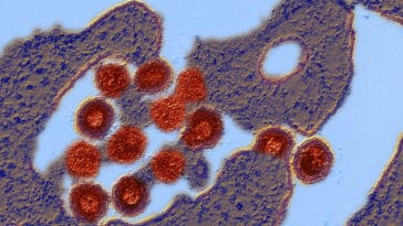 virus placenta