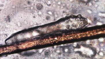 Demodex folliculorum