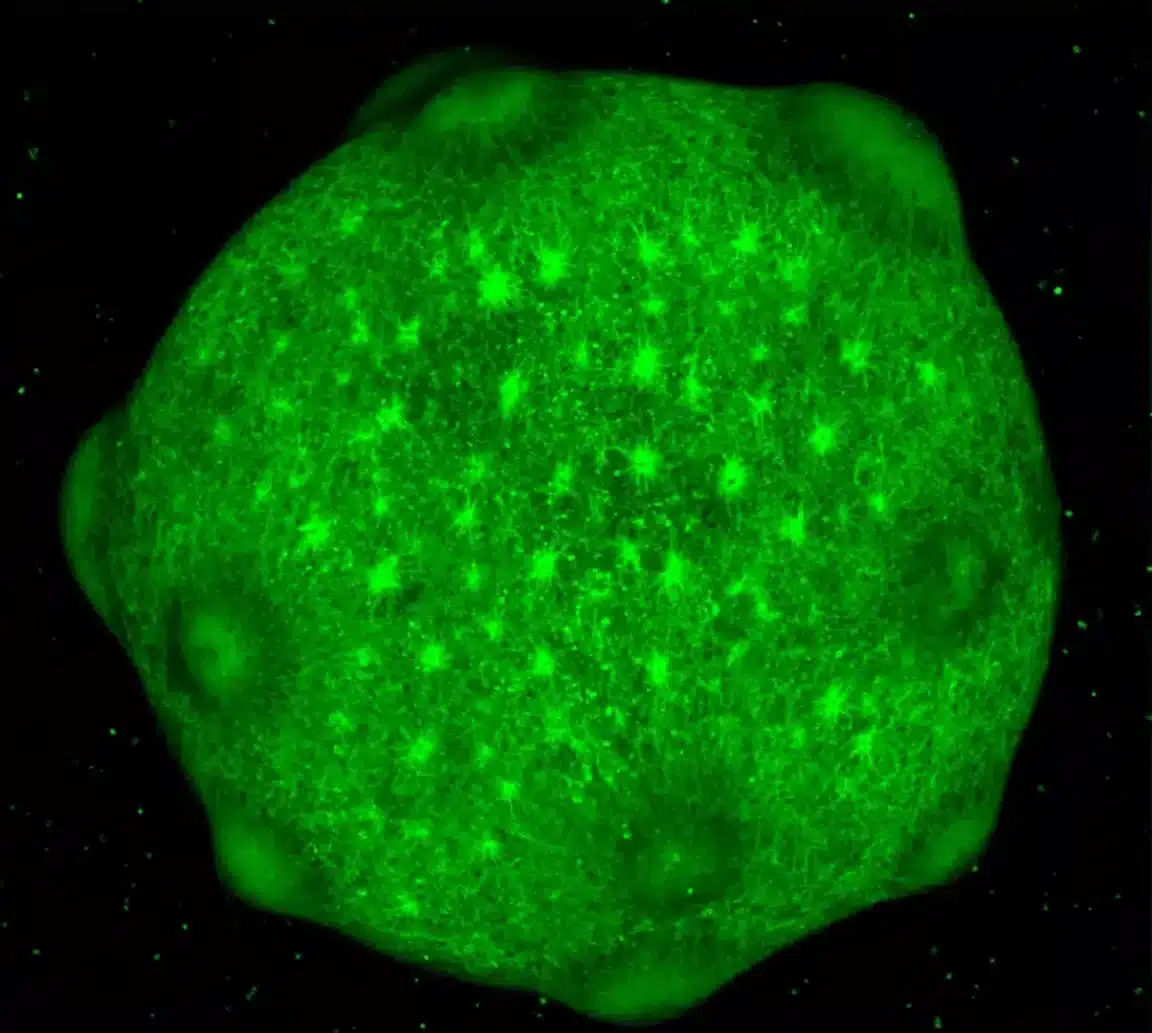 organoïdes cérébraux mini cerveaux