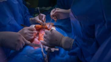 transplantation cardiaque greffes coeur