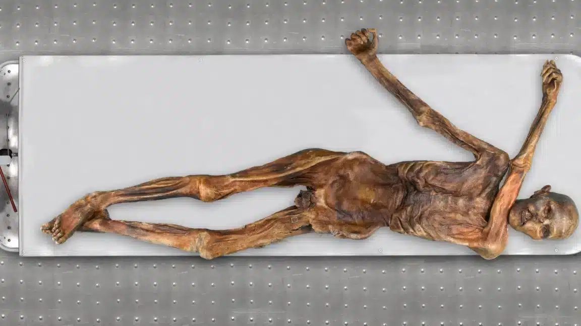 Ötzi