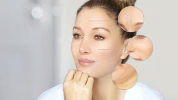 acide hyaluronique peau femme bienfaits visage