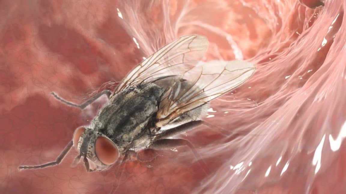 mouche colon cas médicaux