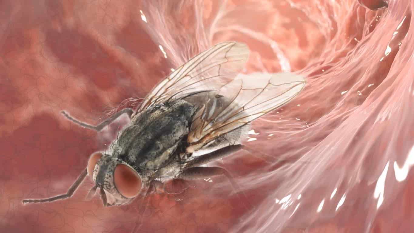 mouche colon cas médicaux