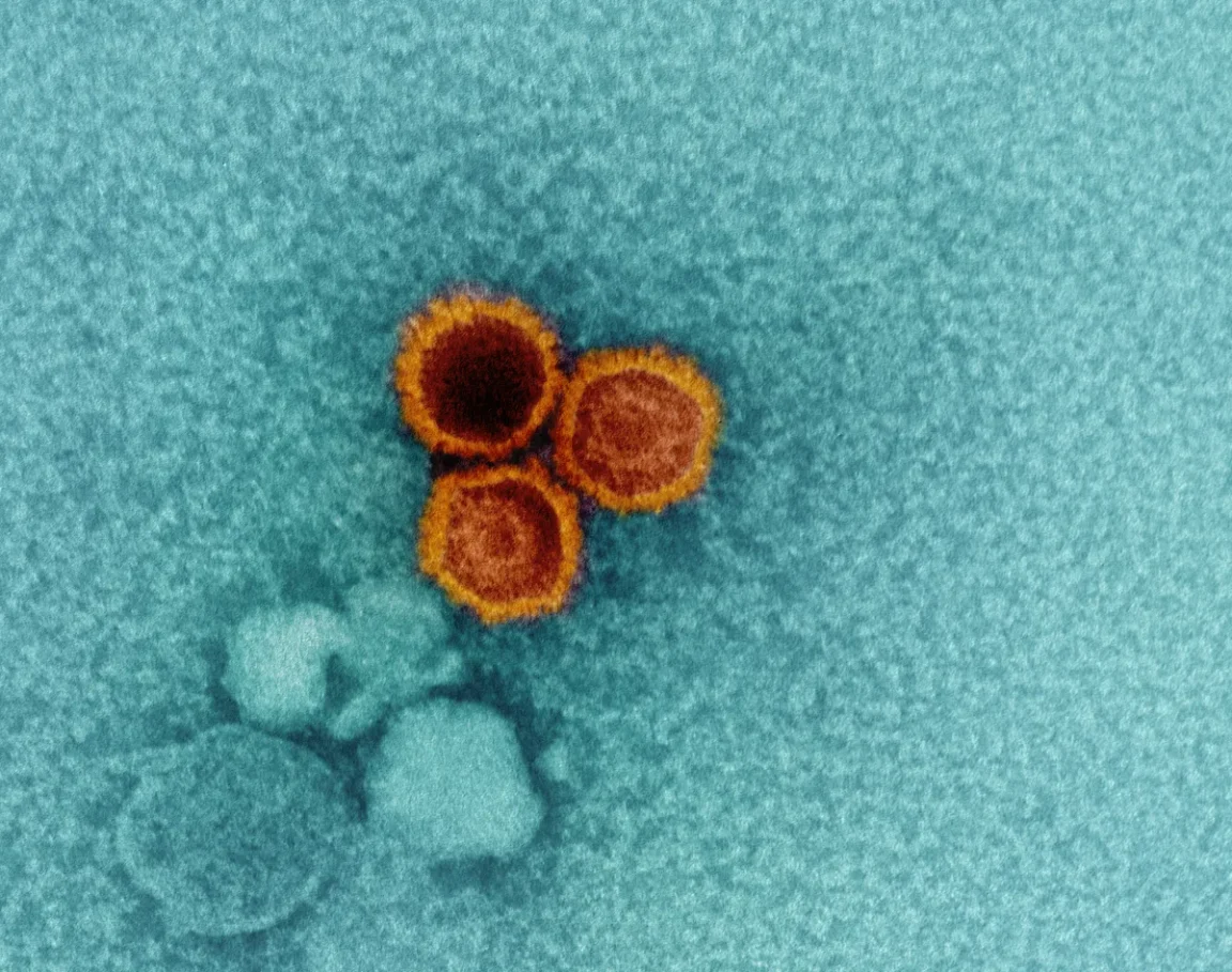 virus Pstein-Barr (EBV)