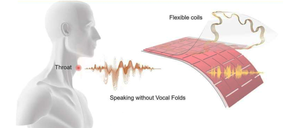 patch pour retrouver la parole sans cordes vocales