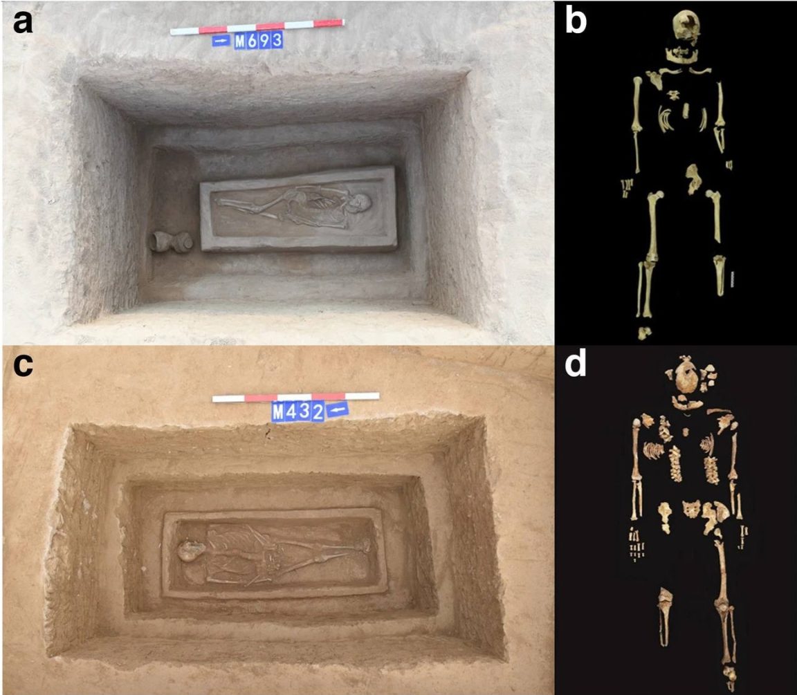amputation punition criminels en Chine squelettes et tombes