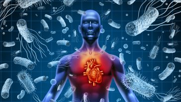 Endocardite bactérienne et septicémie sepsis Cœur et bactéries