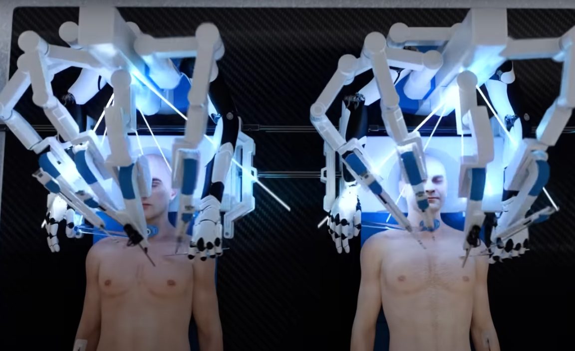 robot transplantation tête 2