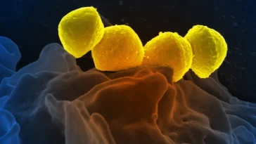 syndrome de choc toxique streptococcique Japon