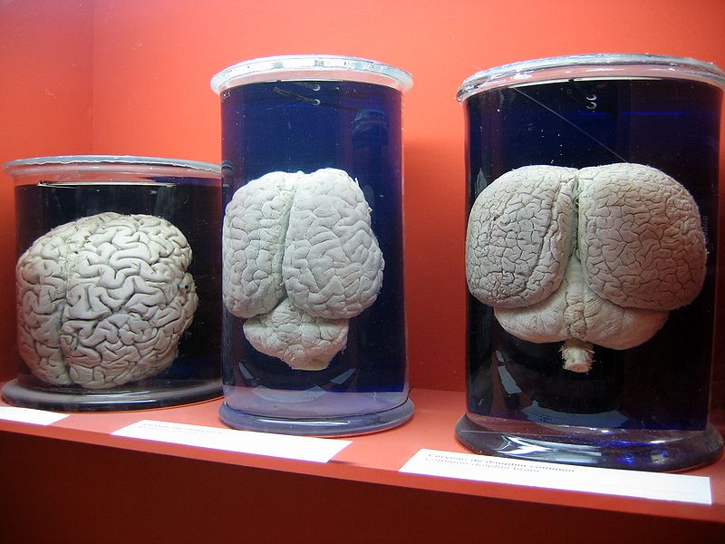 cerveau