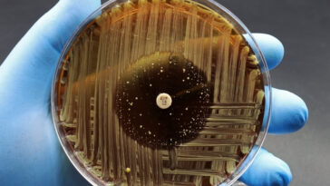 résistance antibiotiques