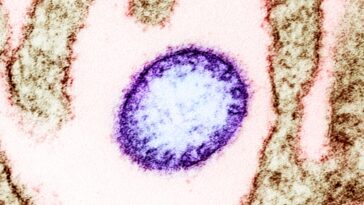 virus Nipah Inde