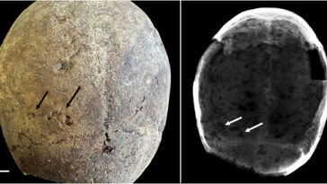 cerveaux XVIIe siècle cocaïne