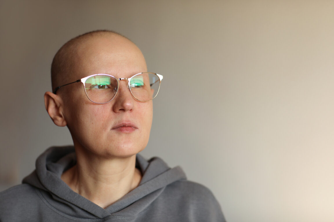 femme perte cheveux cancer