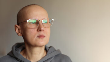 femme perte cheveux cancer