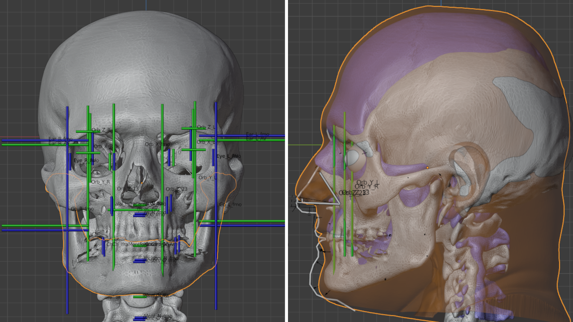 reconstruction faciale visage de saint Nicolas véritable Père Noël