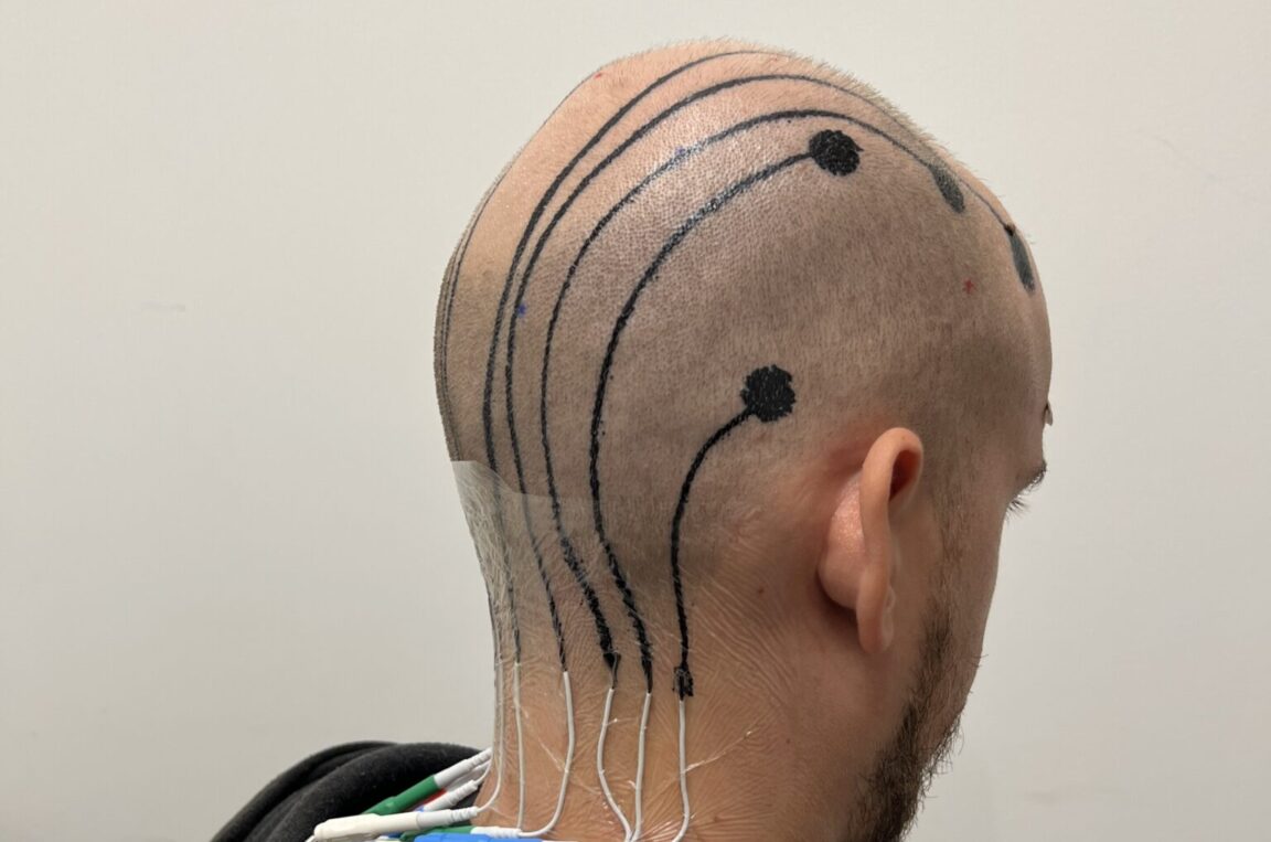 électrodes tatouages