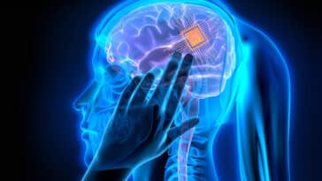 implant lire pensées