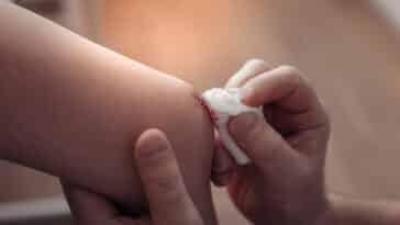 plaie guérison humains