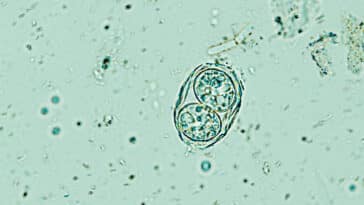 Toxoplasma gondii. chats