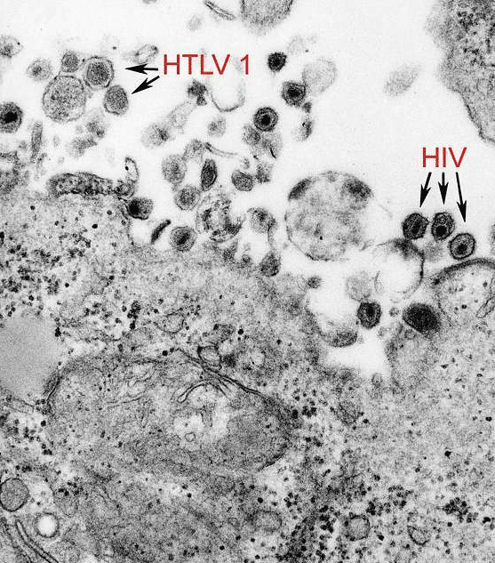 HTLV-1 virus