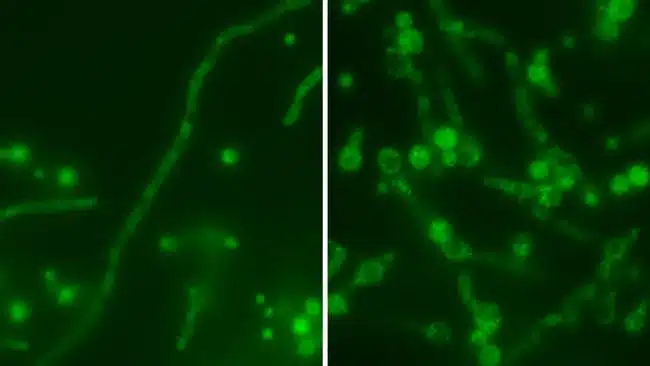 Aspergillus champignon
